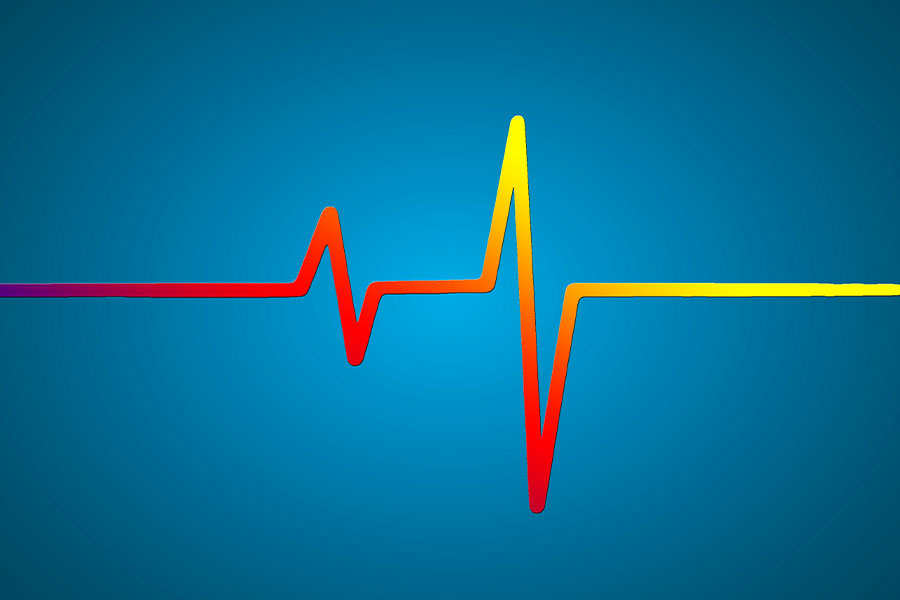 New ECG Guidelines 2017