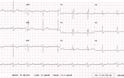 Dr Dave Richley’s ECG of the Month – August 2020