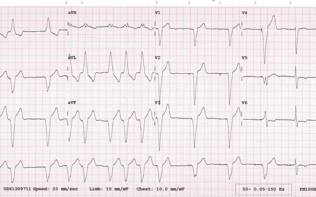 Dr Dave Richley’s ECG of the Month – September  2020