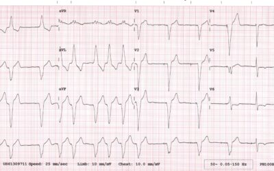 Dr Dave Richley’s ECG of the Month – September  2020