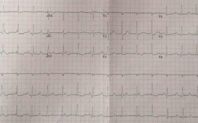 Dr Dave Richley ECG of the Month – February 2021