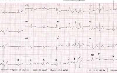Dr Dave Richley ECG of the Month – September 2021