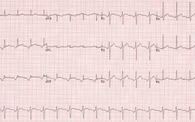 Dr Dave Richley ECG of the Month – January 2022