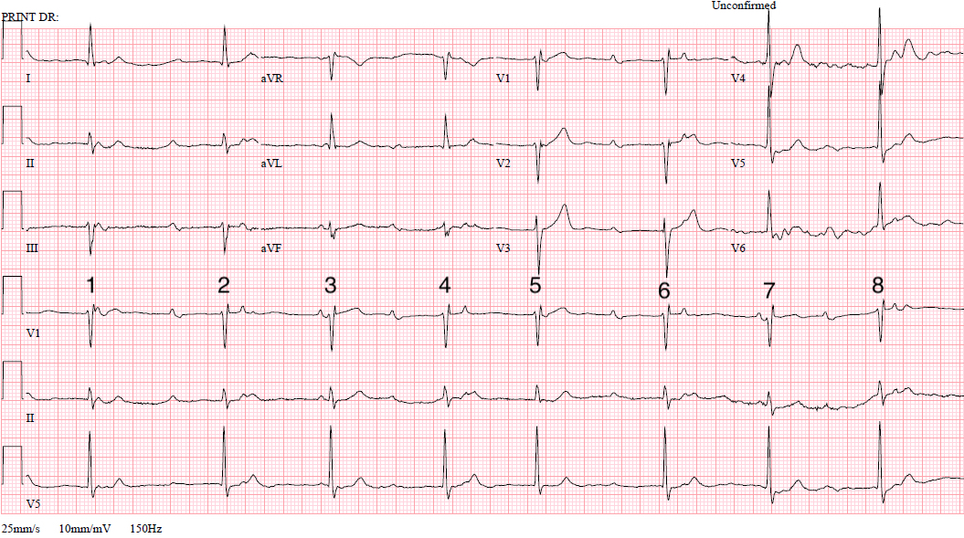 Dr Richleys ECG of the Month – September 2022