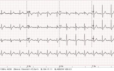 Dr Richleys ECG of the Month – October 2022