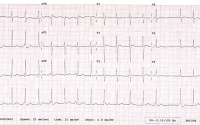 Dr Richleys ECG of the Month – November 2022