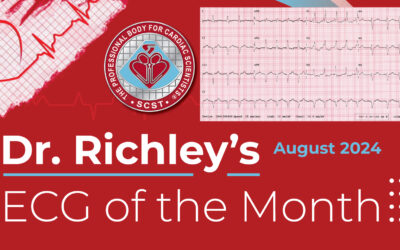 Dr Richleys ECG of the Month – August 2024