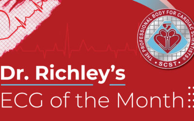 Dr Richleys ECG of the Month – June 2024