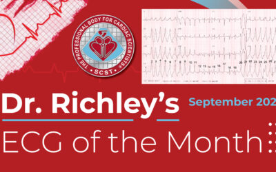Dr Richleys ECG of the Month – September 2024