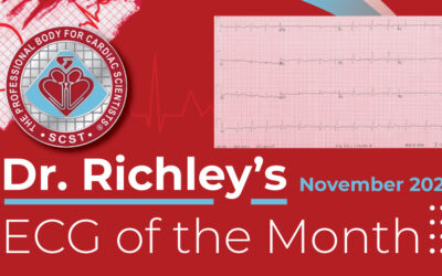 Dr Richleys ECG of the Month – November 2024