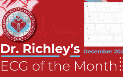 Dr Richleys ECG of the Month – December 2024